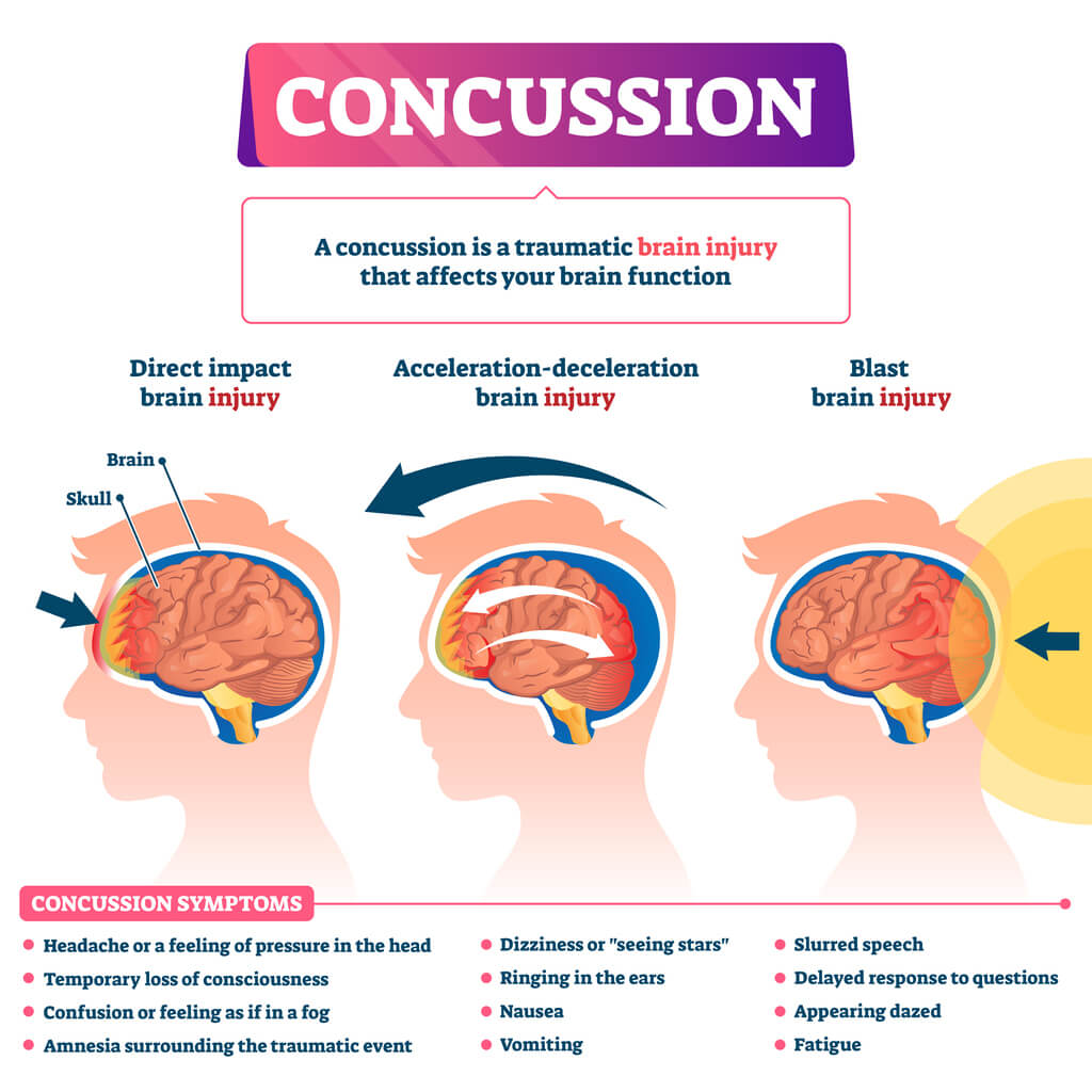 Head Injury Brainstorm Rehabilitation